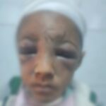 أب يعذب ابنه بعد ضياع 10 جنيهات لشراء سجائر فرط بالمحلة