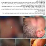 الأمن يكشف ملابسات اعتداء طالب على زميله بـ”كتر” في البحيرة
