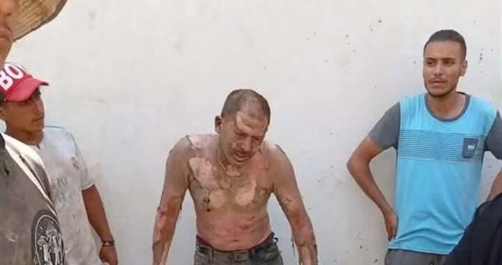 بسبب إزالة كشكه.. مواطن يشعل النار في نفسه أثناء حملة بحي المناخ في بورسعيد
