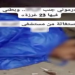 حقيقة فيديو طرد مريض مصاب بالإيدز من مستشفى بالغردقة.. شقيقه يكشف التفاصيل